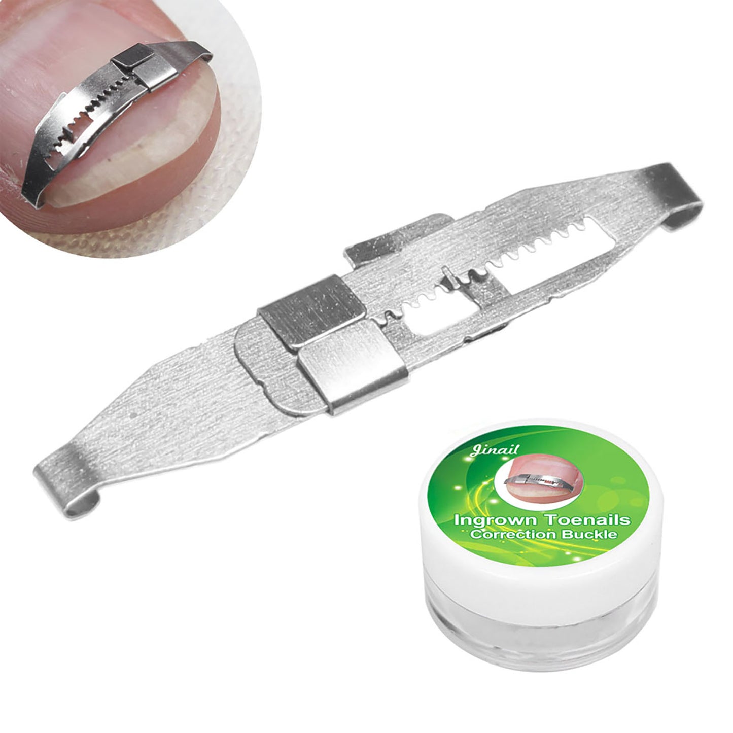 AMONIDA Stainless Steel Ingrown Toenail Corrector Paronychia Treatment Correcting Tool,Ingrown Toenail Corrector,Paronychia Treatment Tool